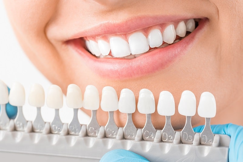 Cosmetic dentures Cosmetic dentures
