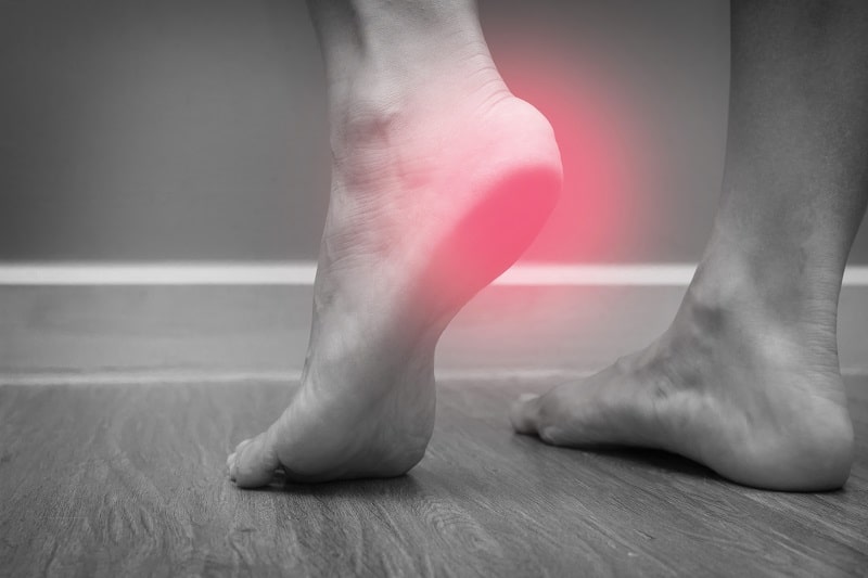 plantar fasciitis