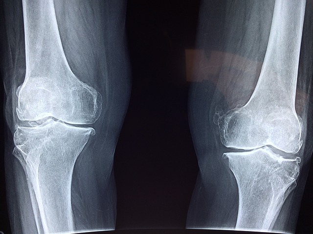 Joint Cartilage